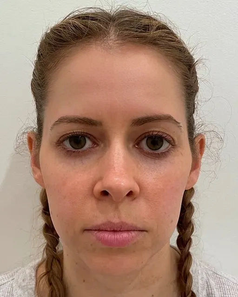 AI-generated treatment prediction